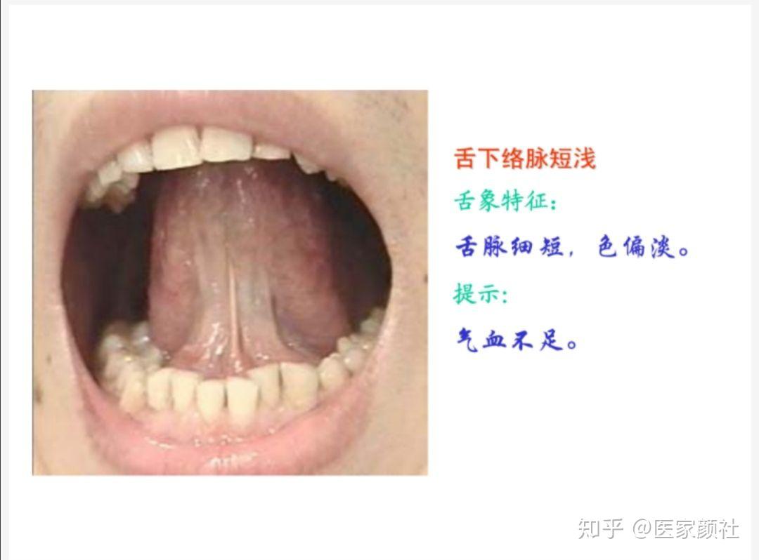 从零开始学中医：舌诊内容和正常舌象 - 哔哩哔哩