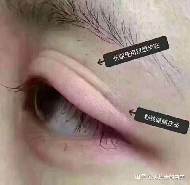内双变外双并不像大家想象的那样简单,同样需要因人而异。 - 知乎