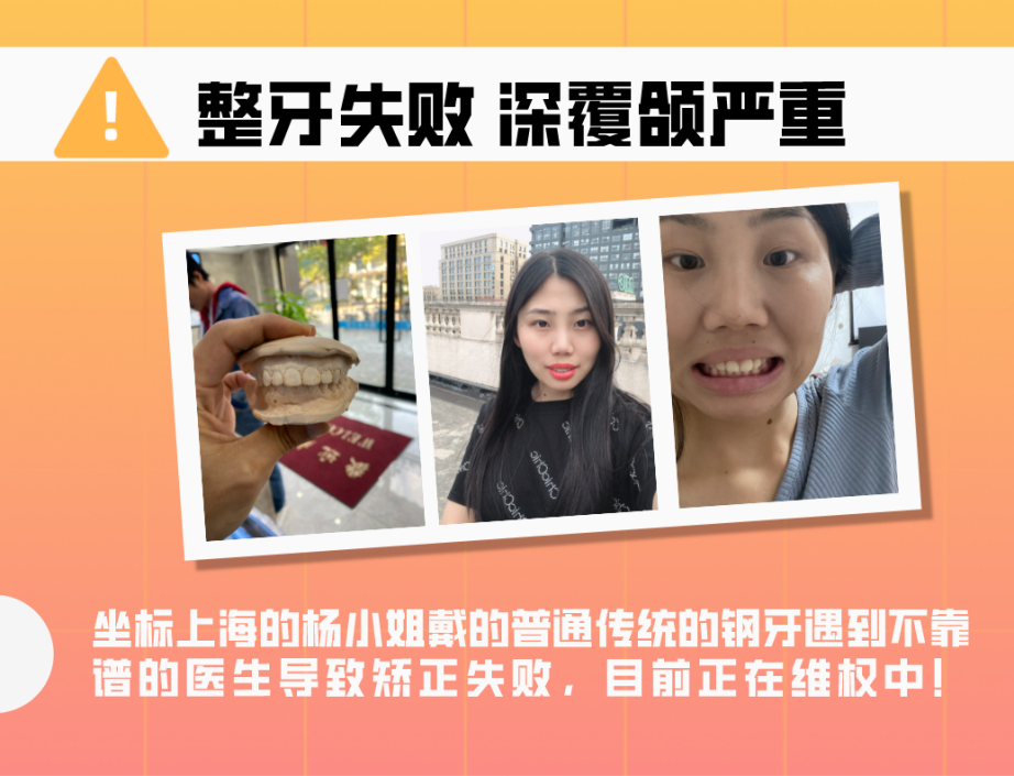 一,牙齿矫正失败后,带给你的伤害是什么?