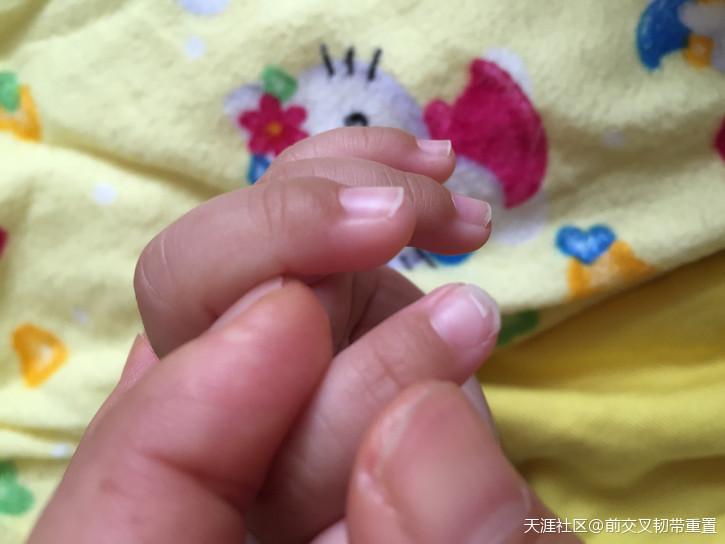 32天宝宝汞中毒血的教训