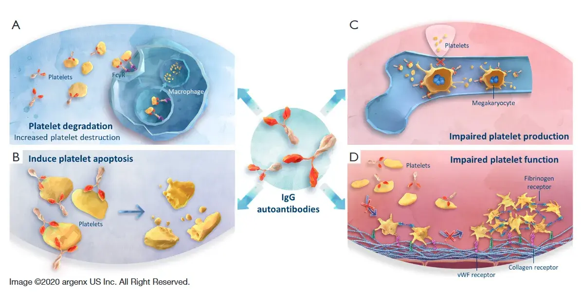 原发性免疫性血小板减少症潜在靶向治疗：FcRn抑制剂Efgartigimod - 知乎