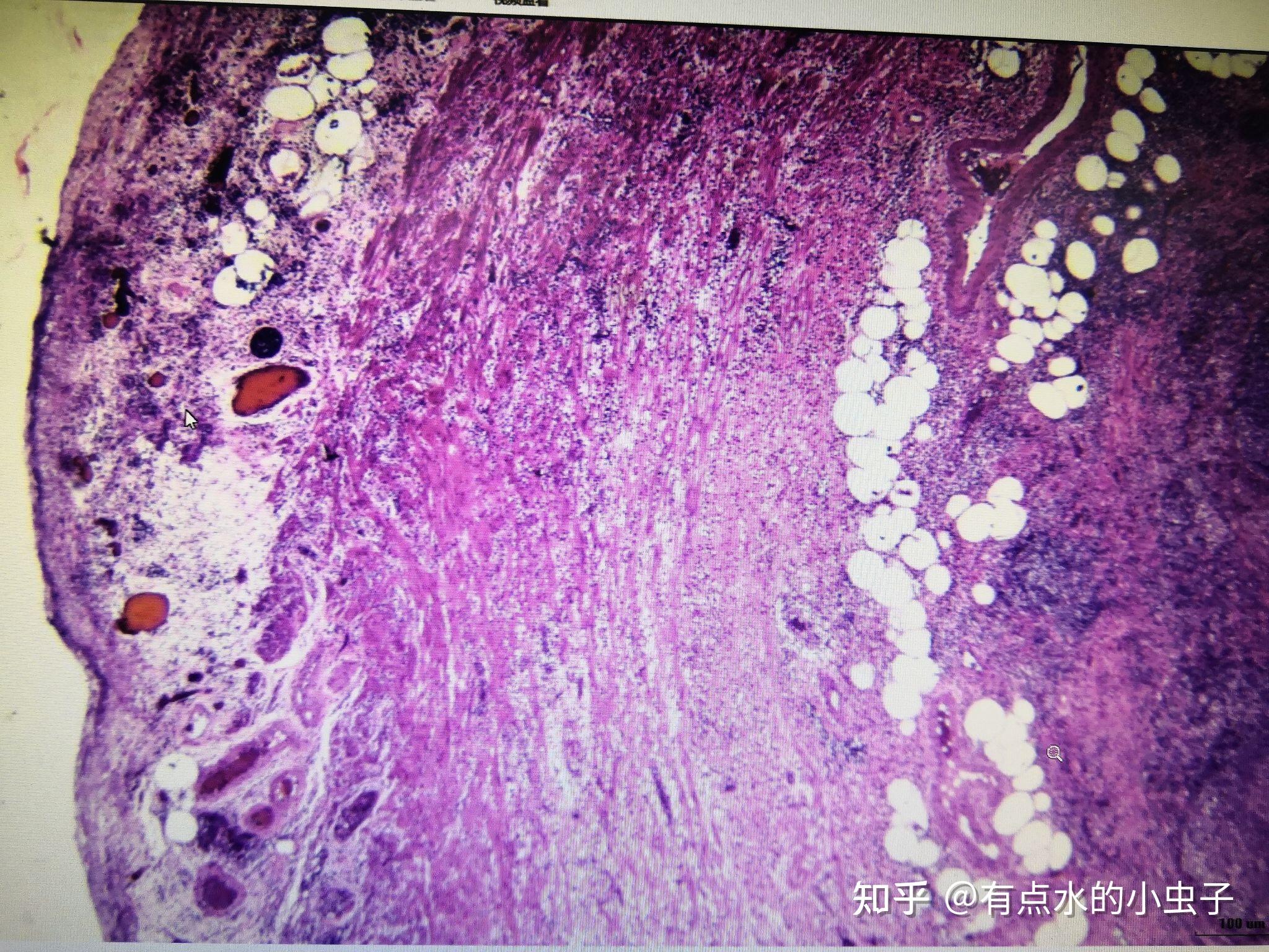 病理切片图镜下