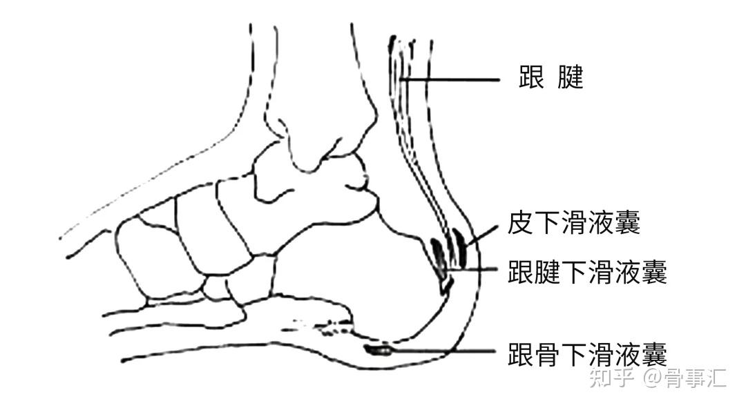 科普| 关注脚后跟疼痛（上）——不同年龄段脚后跟疼痛，都在这里了 - 知乎
