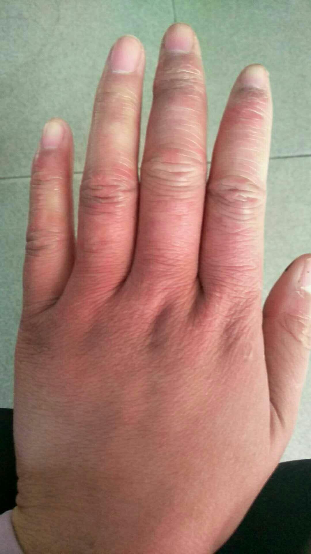 手是女人的第二张脸可是我的手却很丑