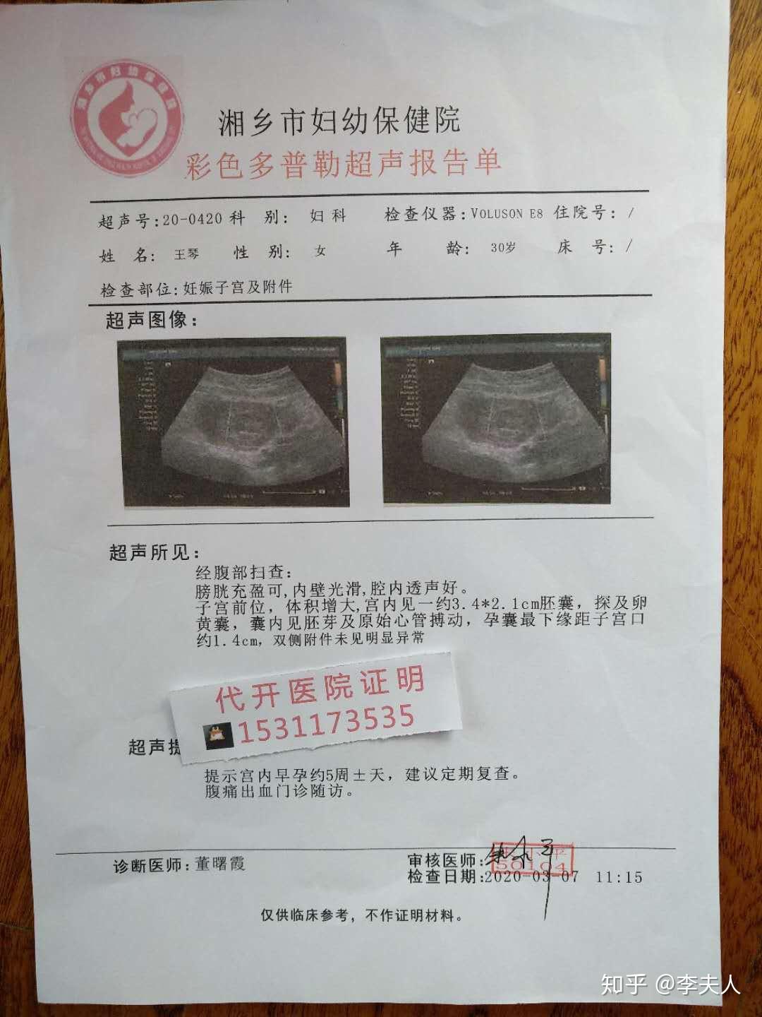 怀孕的时候是需要进行b超检查的