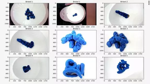 就是用这些橡皮泥做的蓝色假便便,研究人员正在尝试根据布里斯托大便