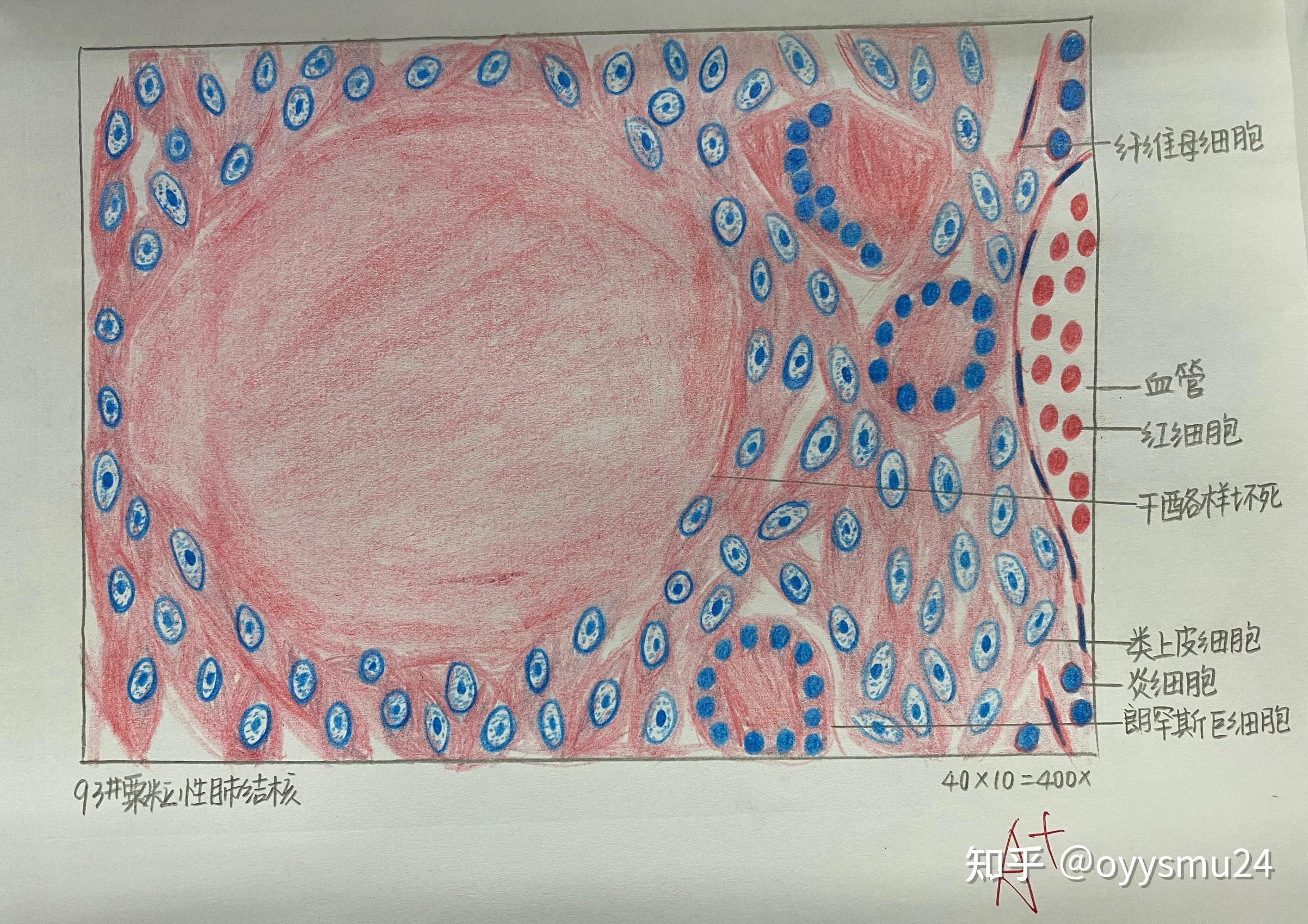 弧菌红蓝铅笔绘图图片