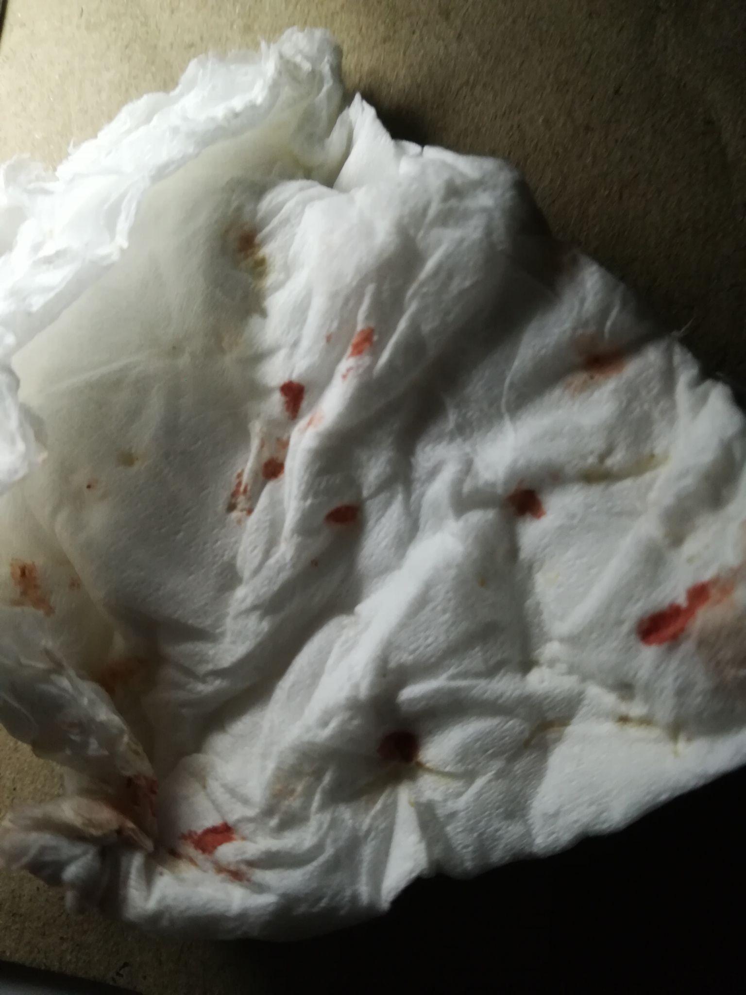 自己扣掉了牙结石是种什么体验。