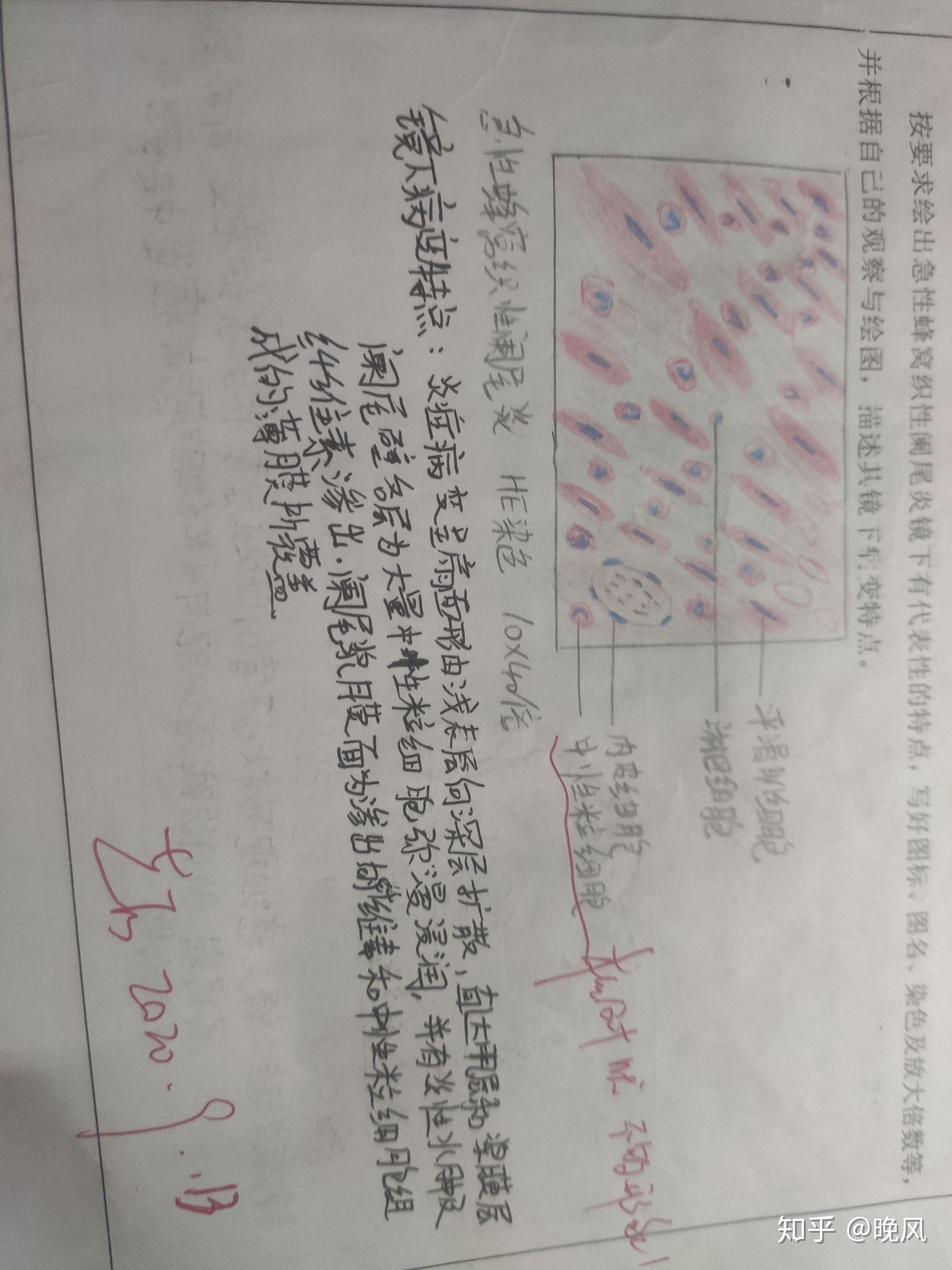 肝脂肪变性学渣字丑,图画的丑,将就一下