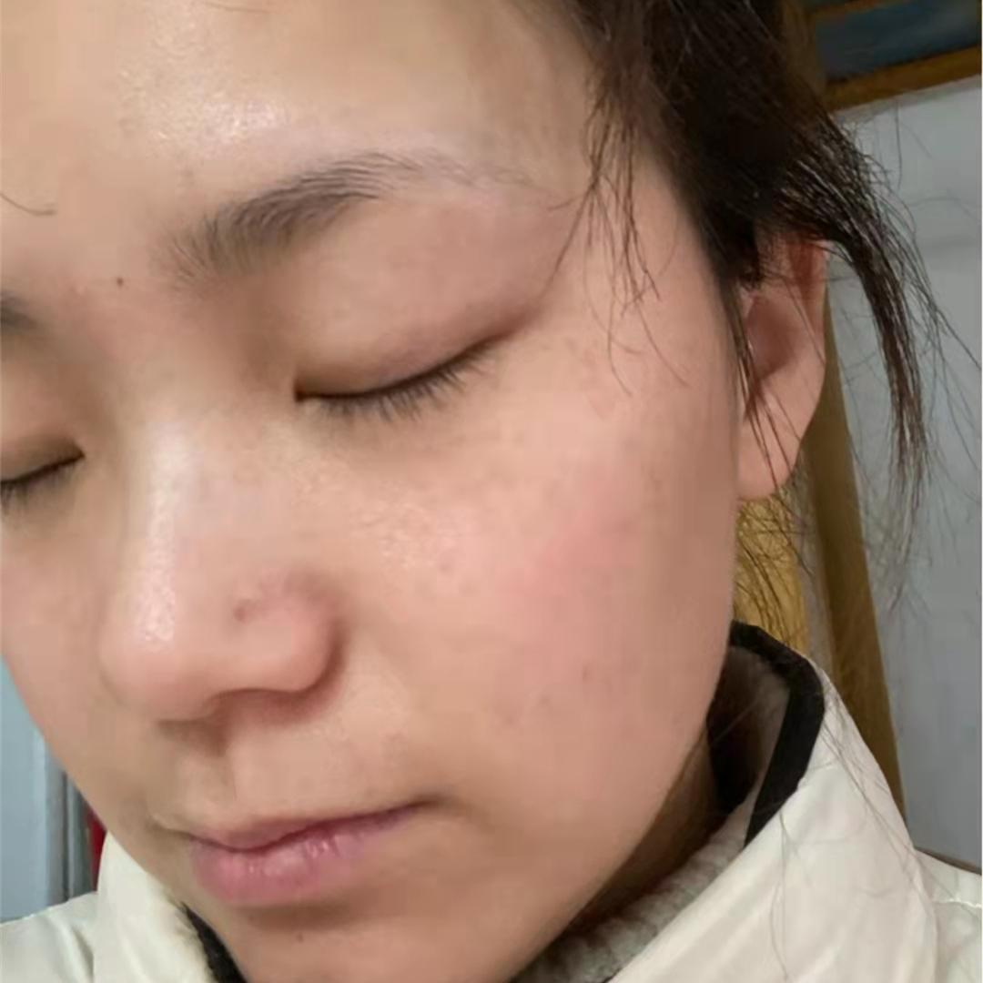 怎么淡斑祛斑 有什么好产品推荐嘛? - 知乎