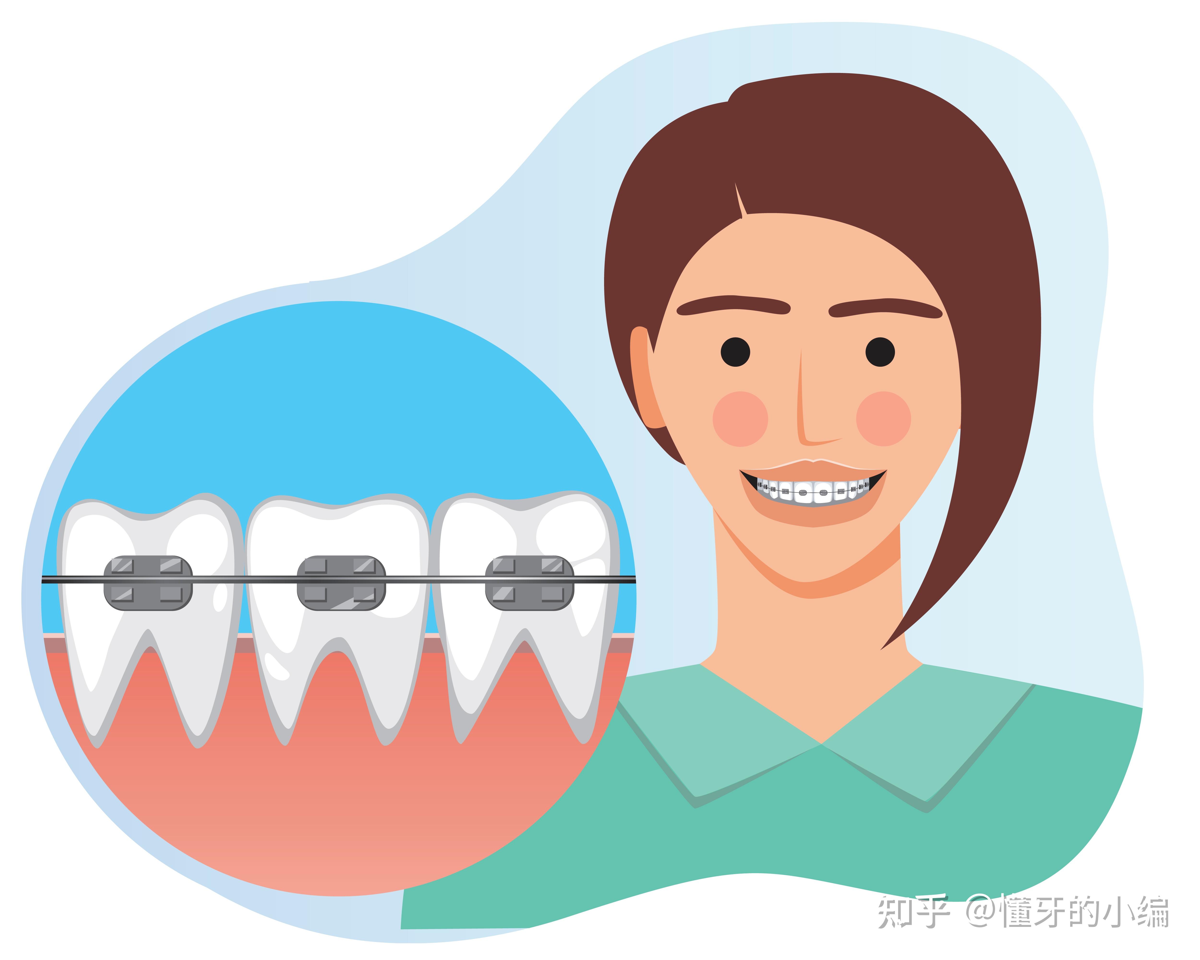 牙齒矯正到底有多疼