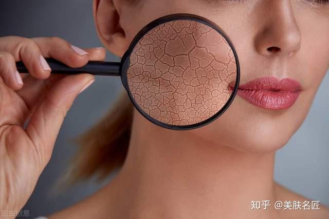 角质层薄皮肤屏障受损怎么修复请认准这三个关键词