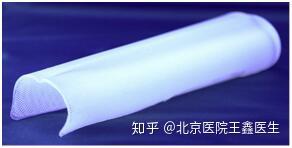 [ 阴茎增大] 自体脂肪、脱细胞异体真皮、玻尿酸和Penuma®哪种填充材料更具优势？ - 知乎