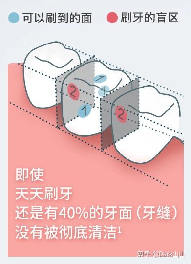 新手怎么快速学洁牙 v2-db55743e9906312f6d694d711833d56c_b.jpg