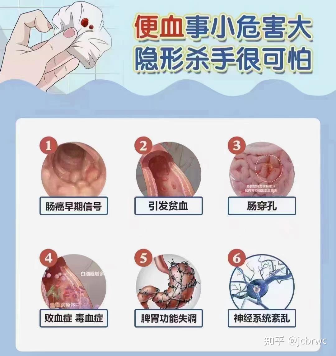 便血危害大 - 知乎