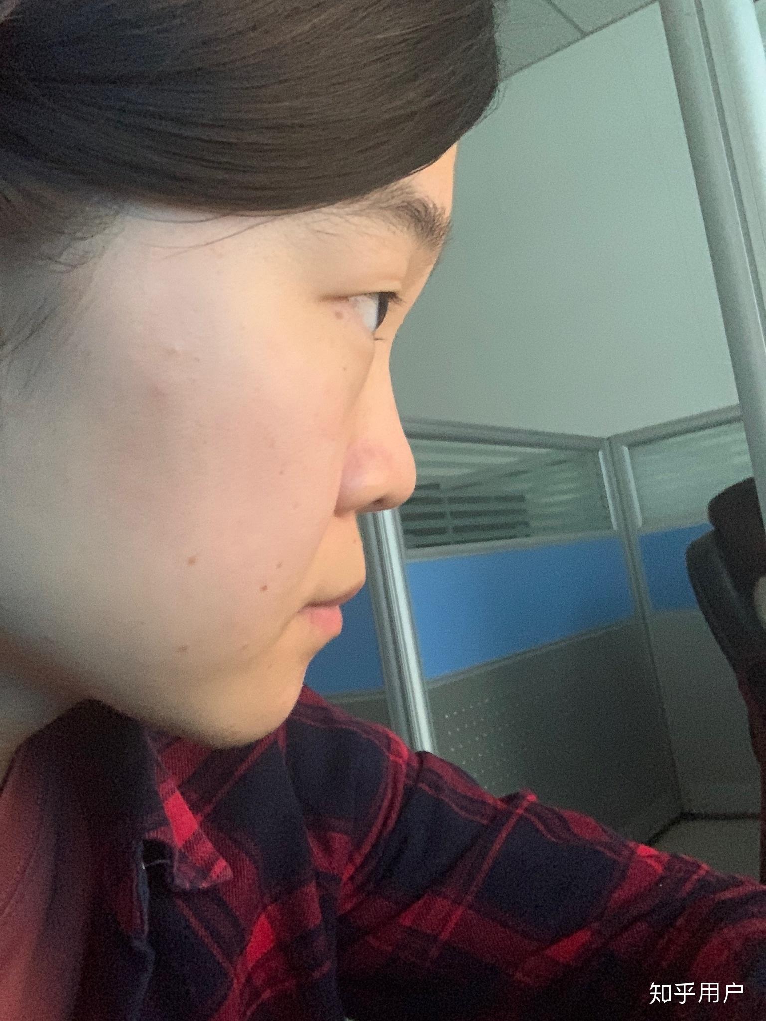 没有山根是种什么体验