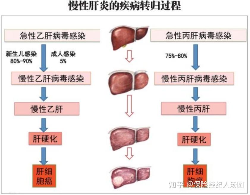 为什么我国的乙肝携带率很高