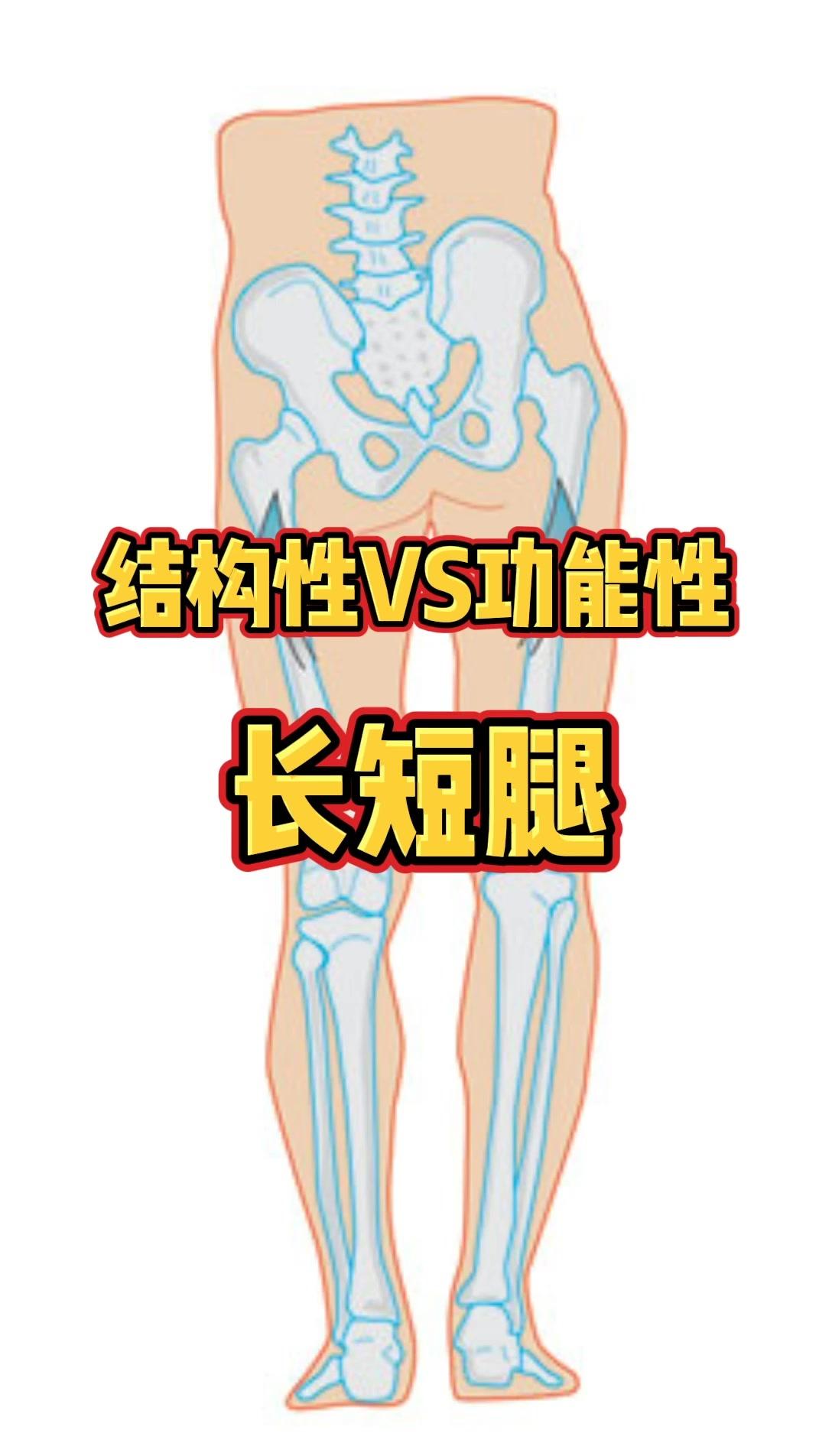 67体态矫正功能性和结构性长短腿的一些问题