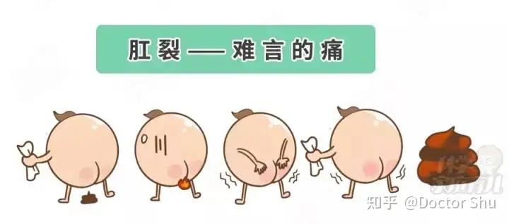 肛裂的人怎么办