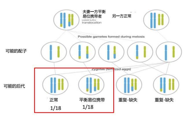 染色体平衡易位