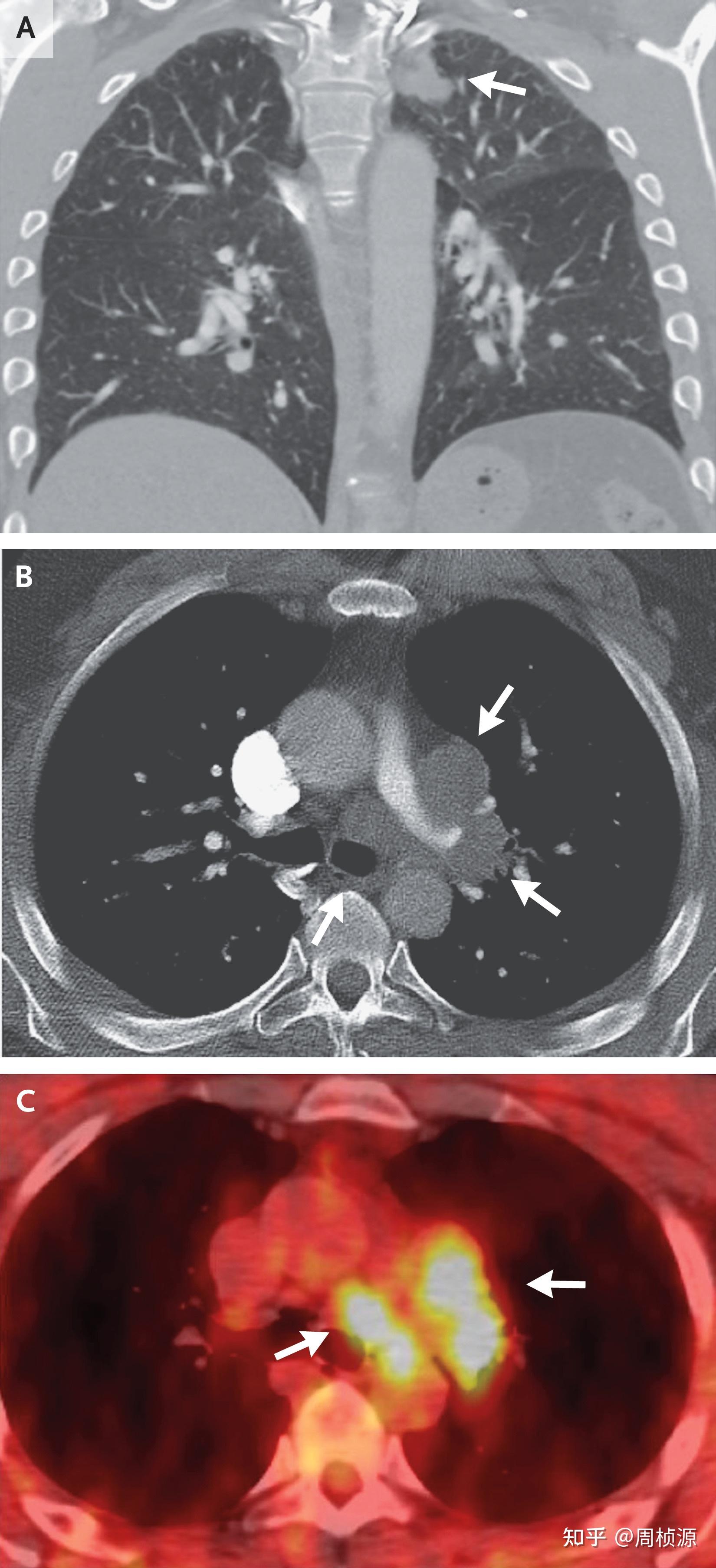 nejm-2023-case-1