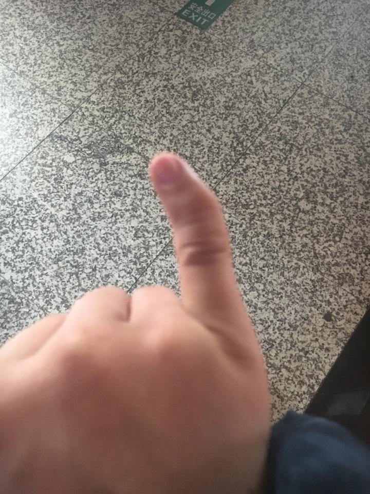 为什么小拇指是弯的