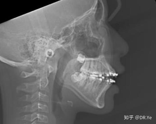 深入了解复位过程与技巧 (深入了解复位的方法)