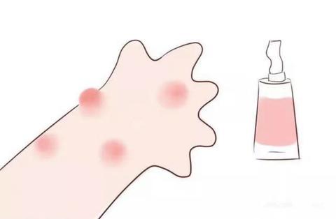 驱蚊用哪种好 v2-dcc54af337b75111042556ac6b5a8d5c_180x120.jpg