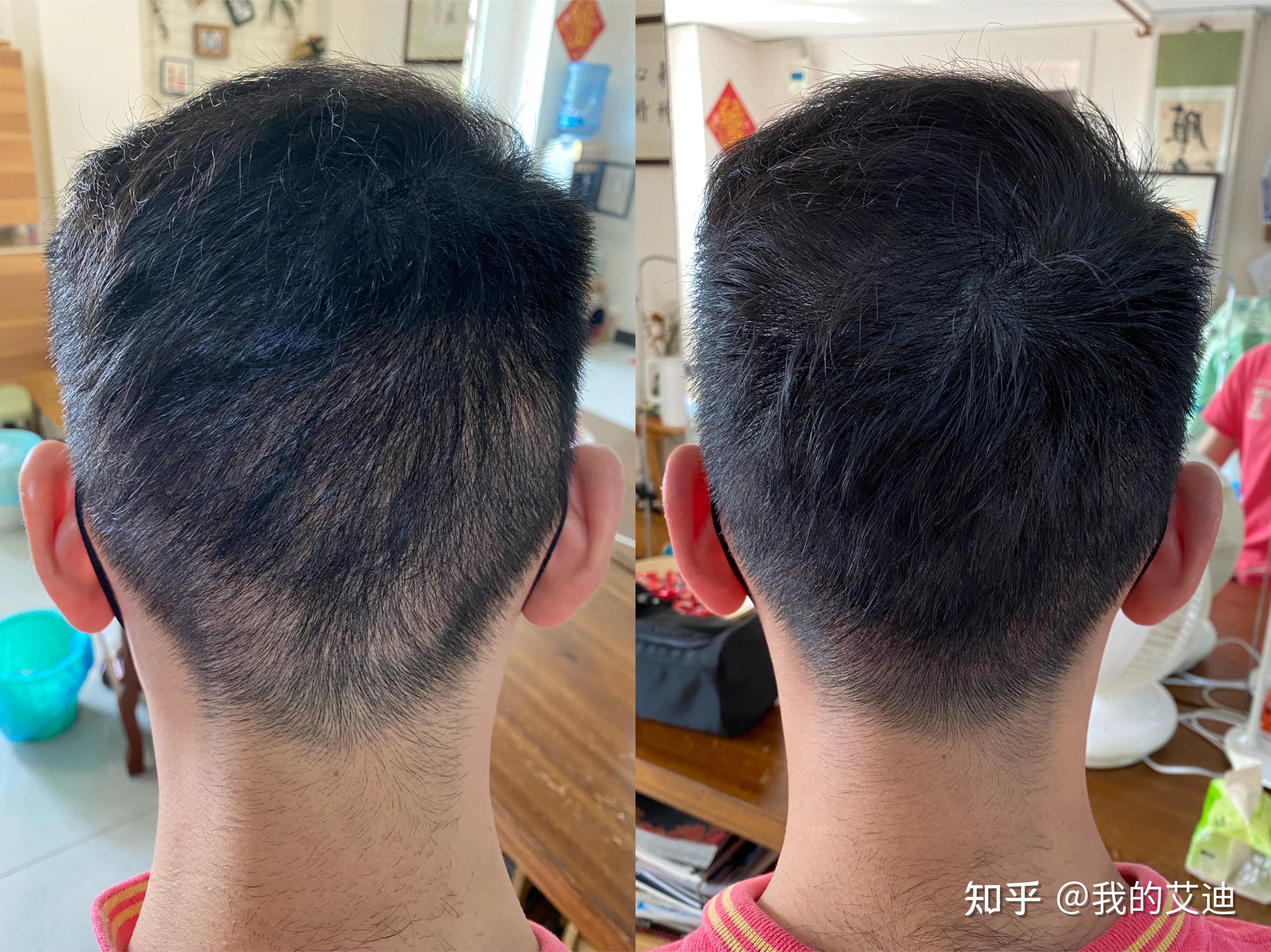 纹发取发区 - 知乎