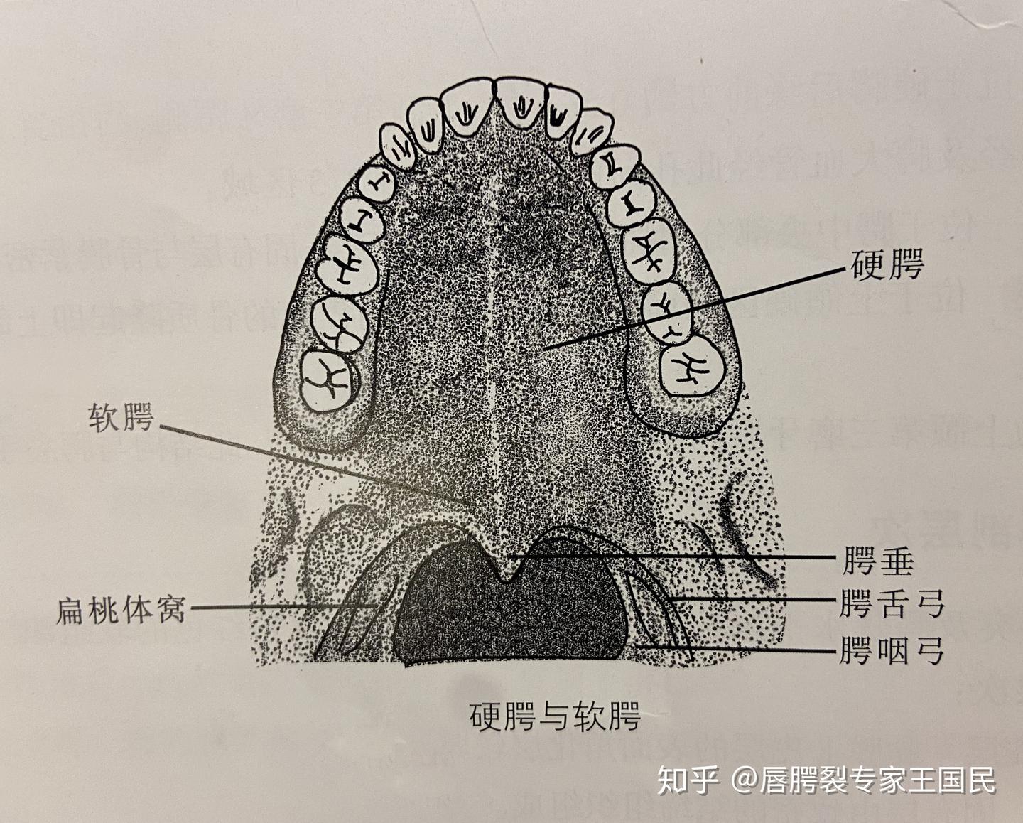 唇腭部的生理解剖特点之腭的解剖(二) - 知乎