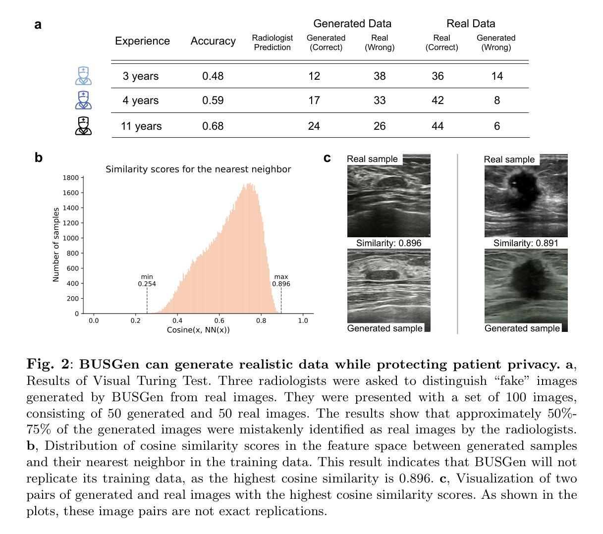 医学影像/Breast Ultrasound