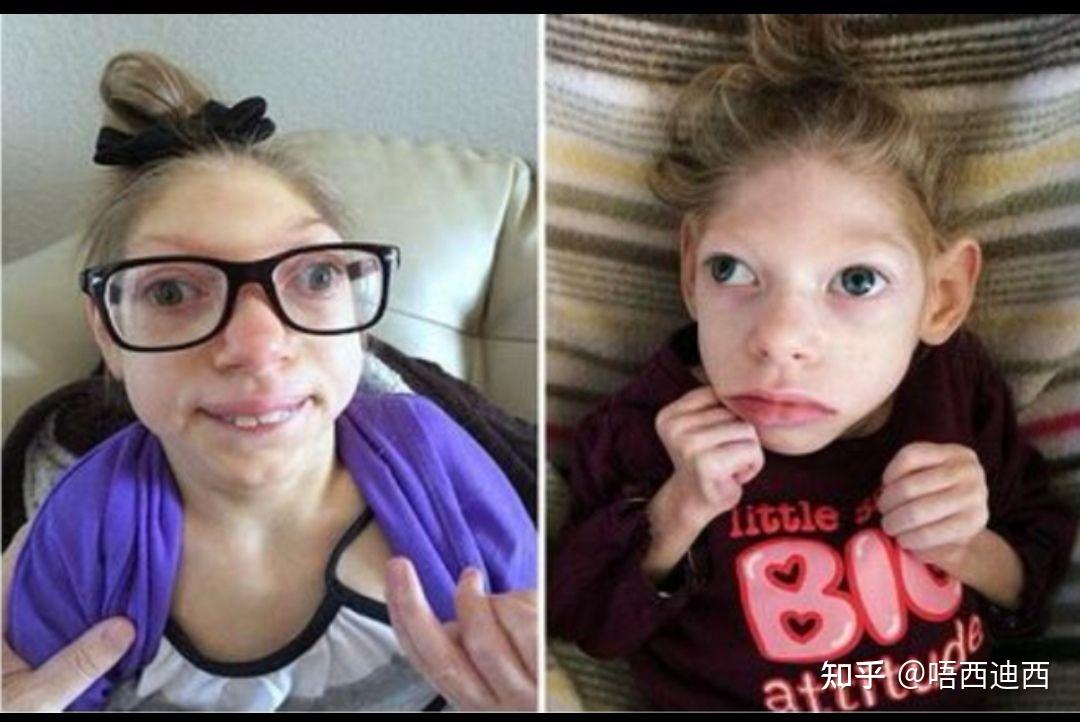 小时候是圆头为什么长大就扁了? - 知乎