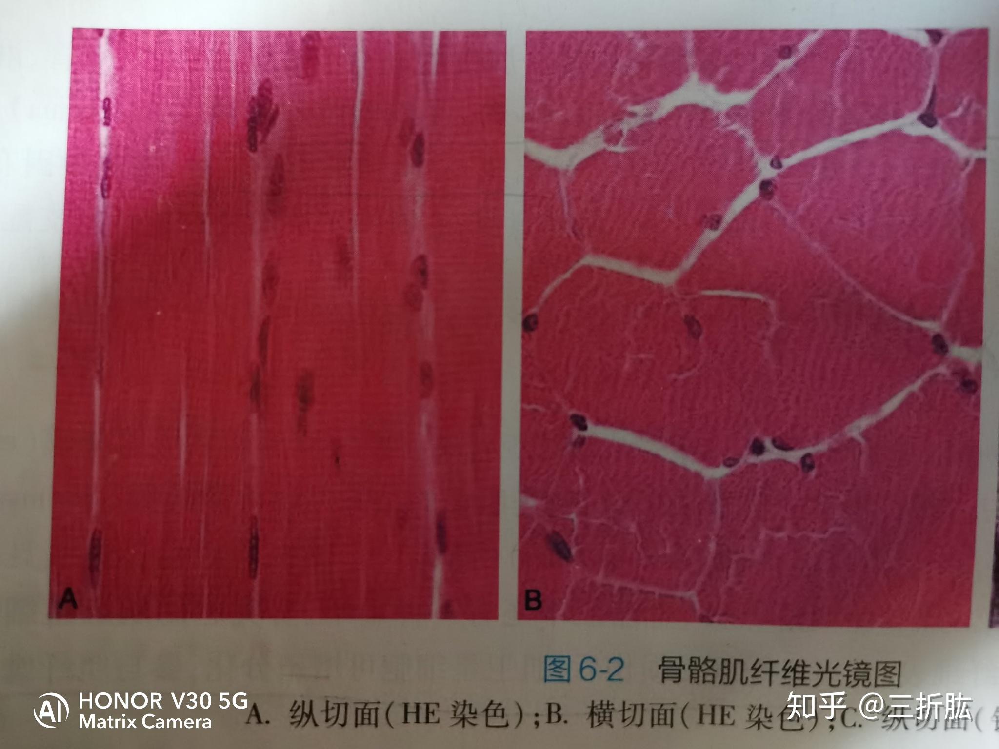 肌纤维是肌肉细胞吗那它的细胞核在哪里