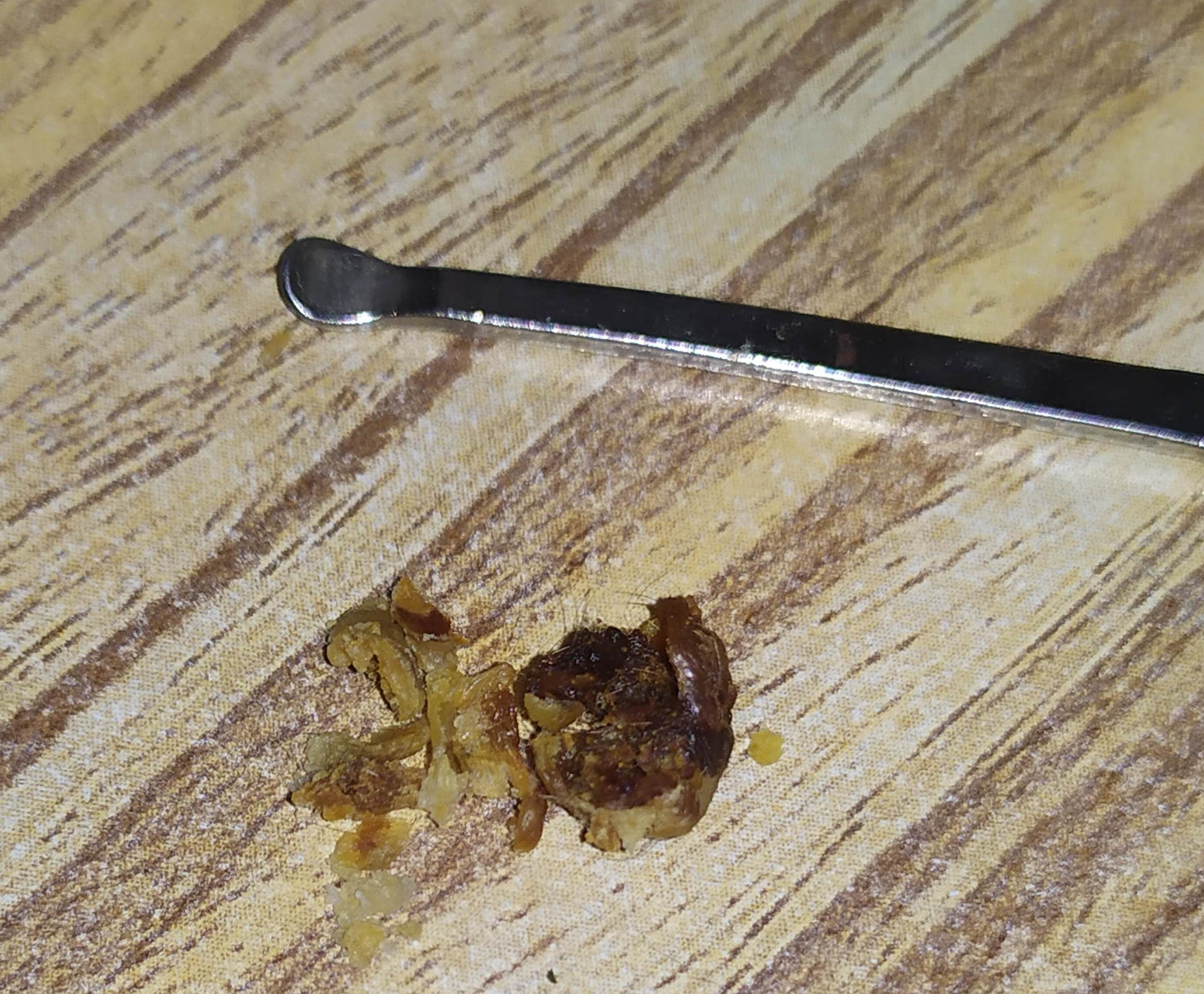 耳屎最大能有多大? - 知乎