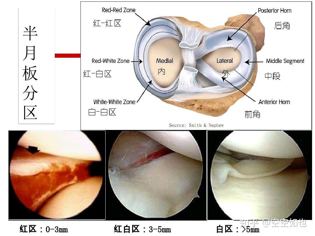 半月板外侧前角血运多么