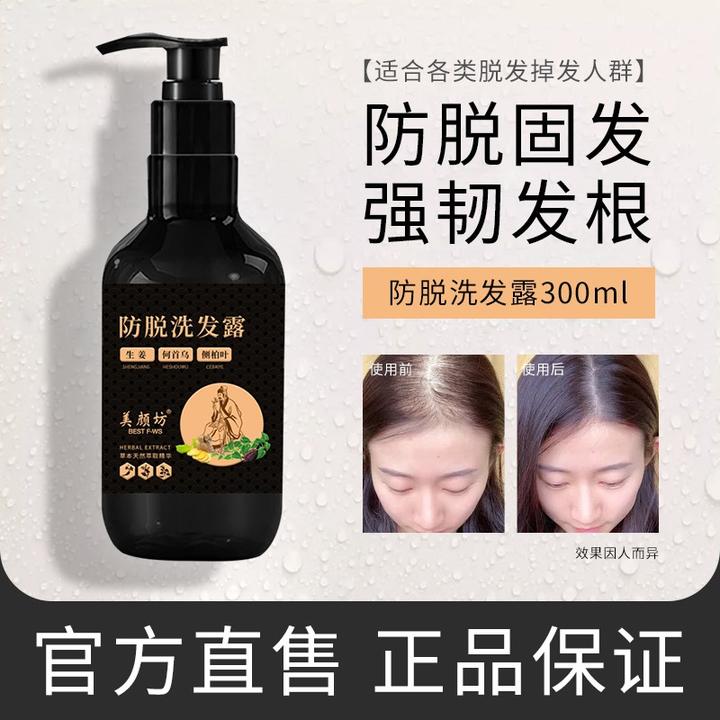 美颜坊米雅诗防脱洗发露生姜洗发水防脱发育发洗头膏男 京东 139.00