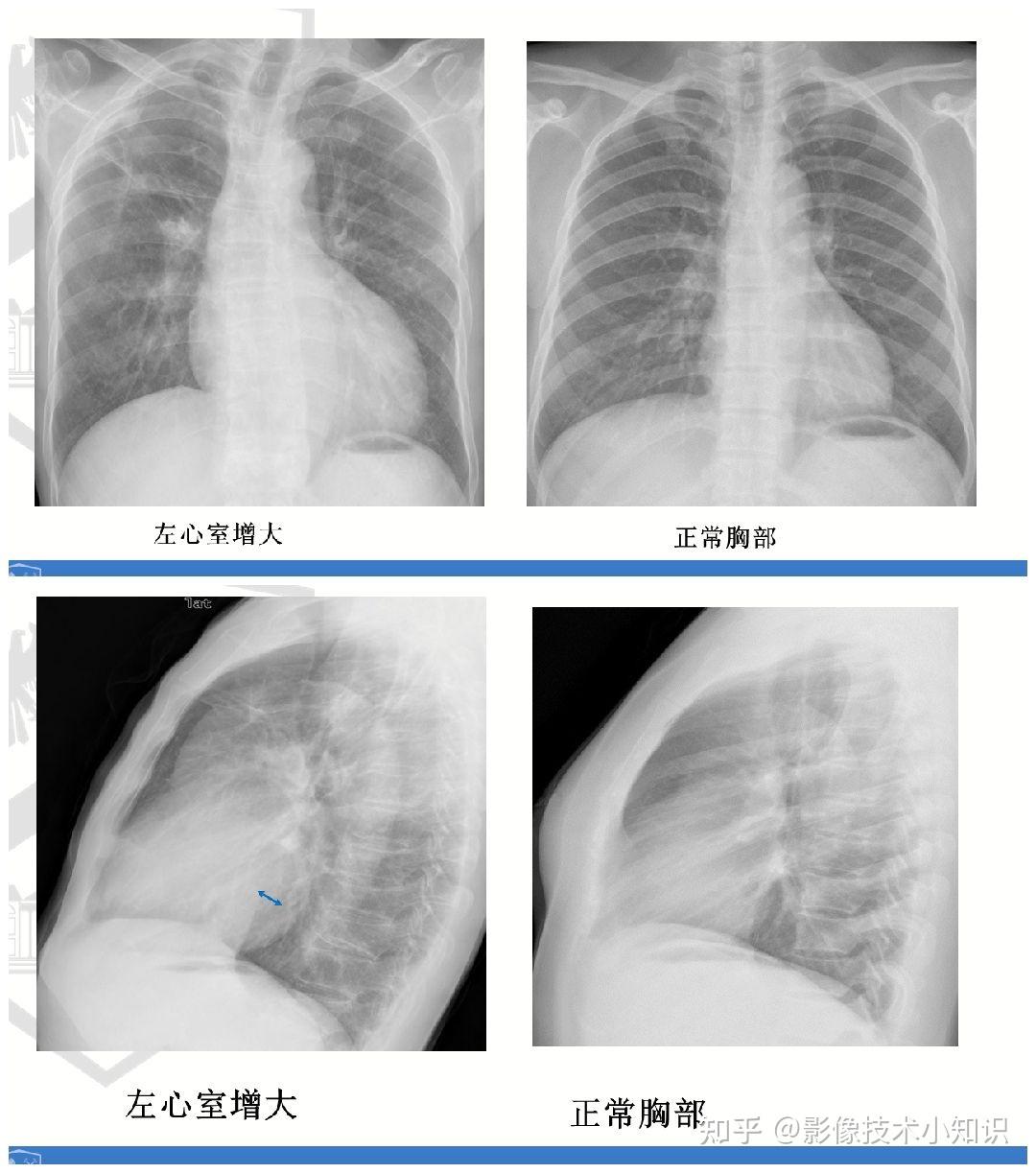 对你很有帮助的心脏影像知识