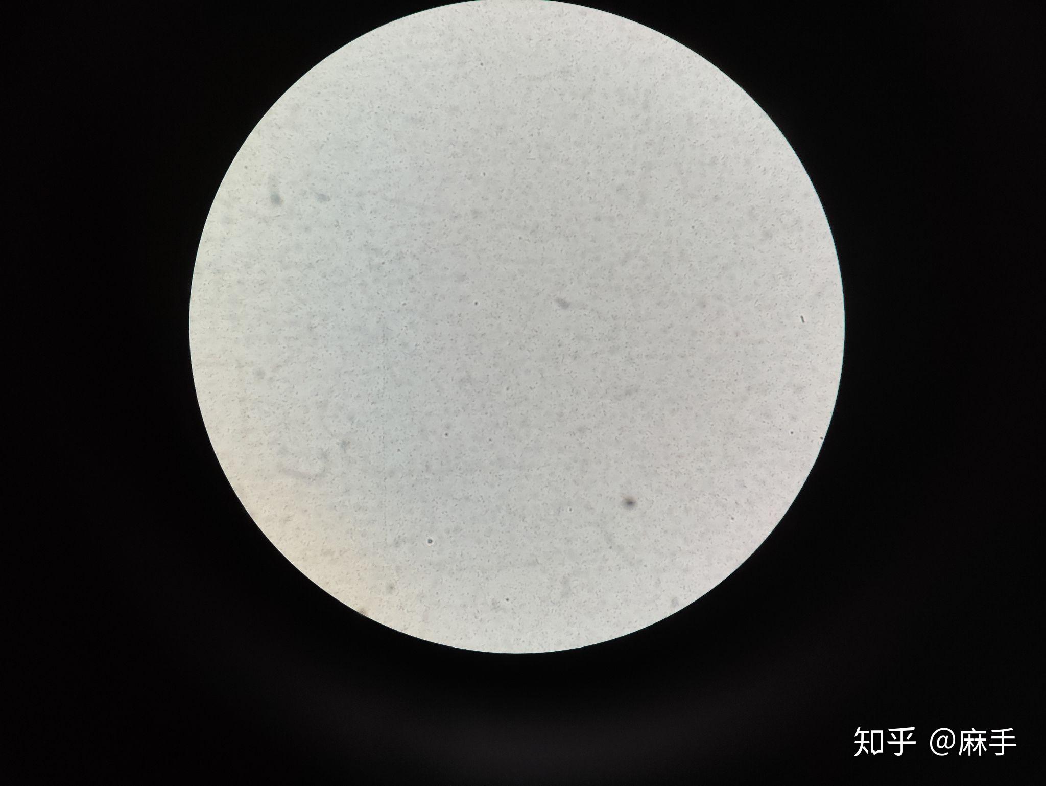 显微镜下的大肠杆菌是什么样子的呢很可爱呢