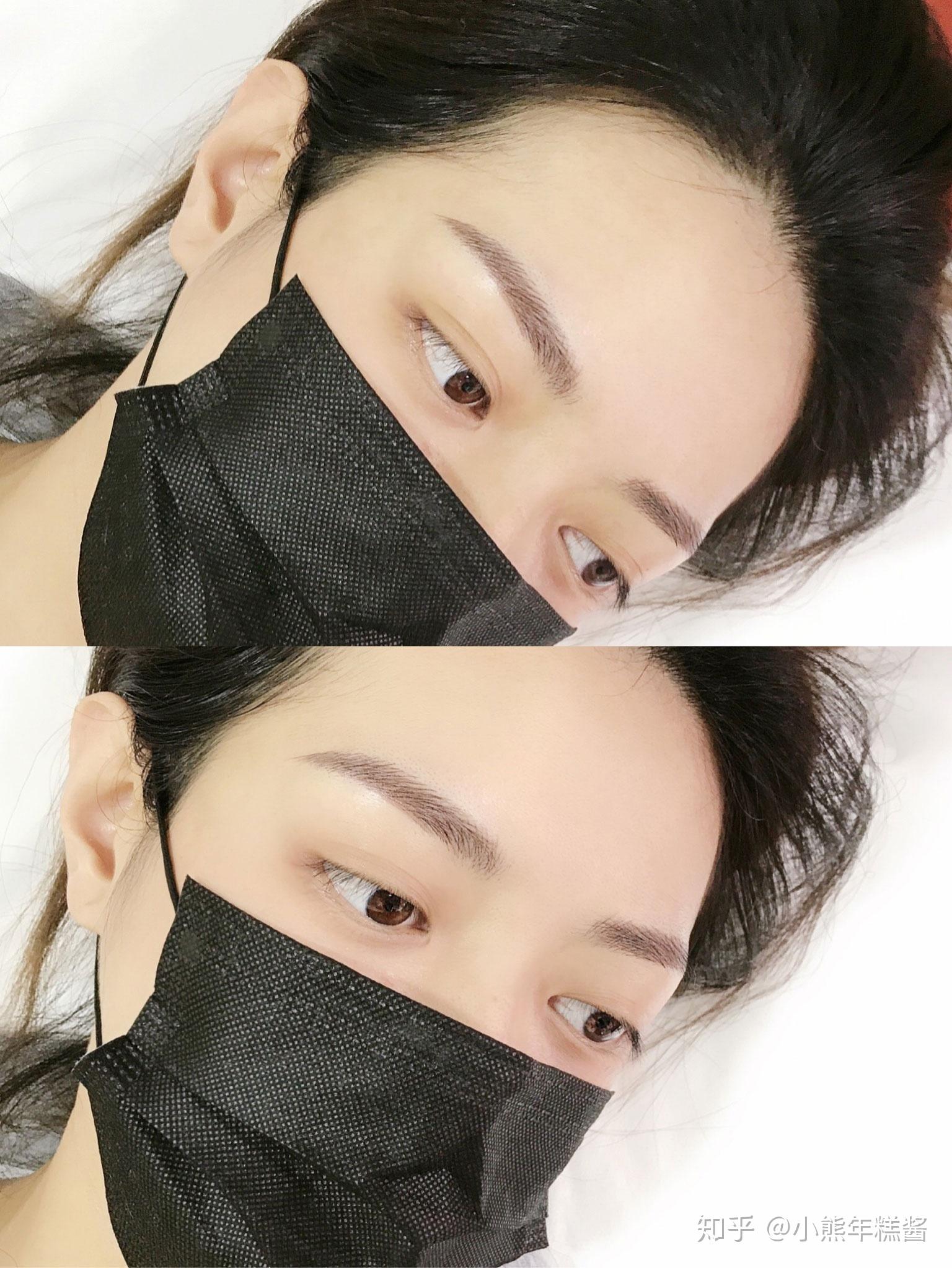 柒号美学纹眉的恢复期是多长时间你知道吗?