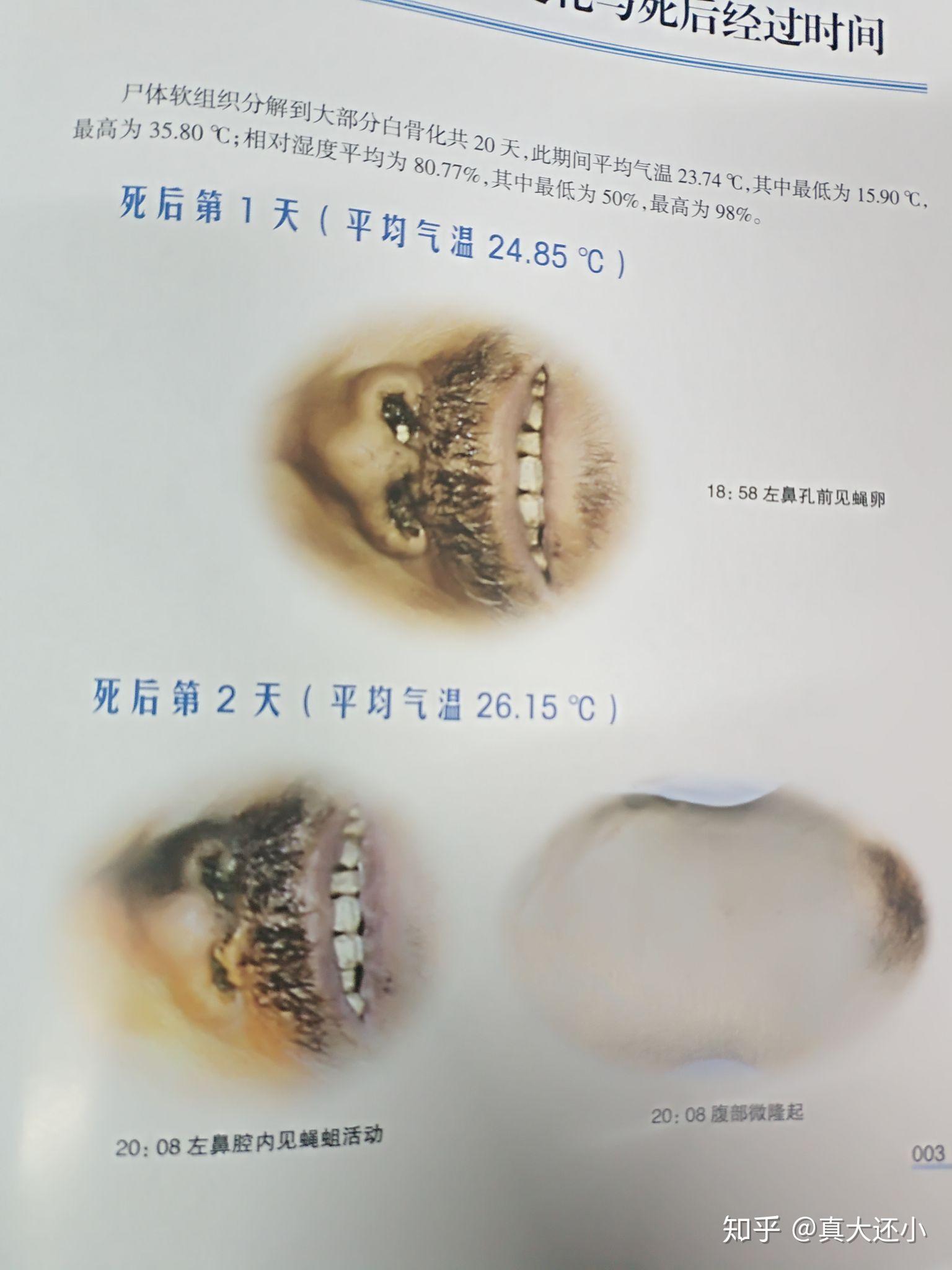 如何评价《尸体变化图鉴》这本书? - 知乎