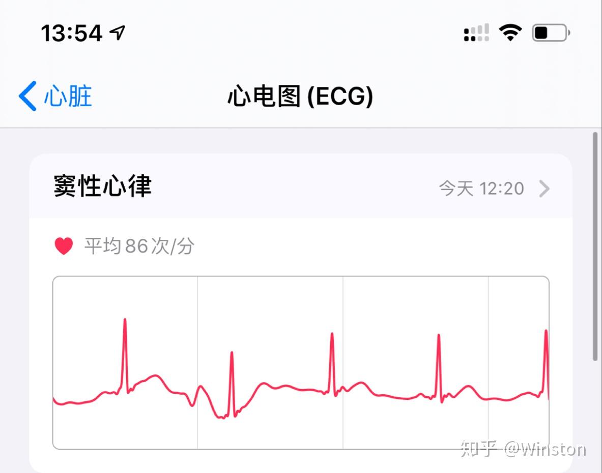 国行 apple watch的ecg(心电图)能用港区/美区账号激活吗 ?