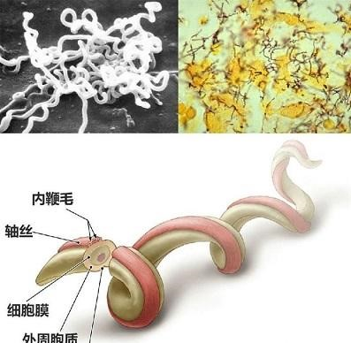 v2-ddd51775b0da6cd324c1c1f519a85c88_b.jpg