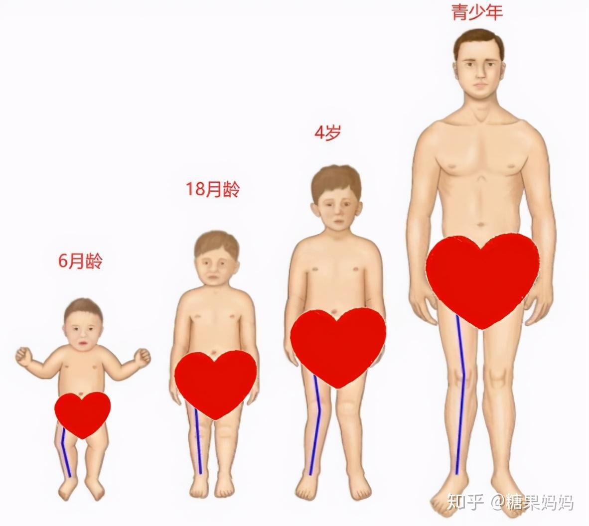 宝宝脊柱突出图片