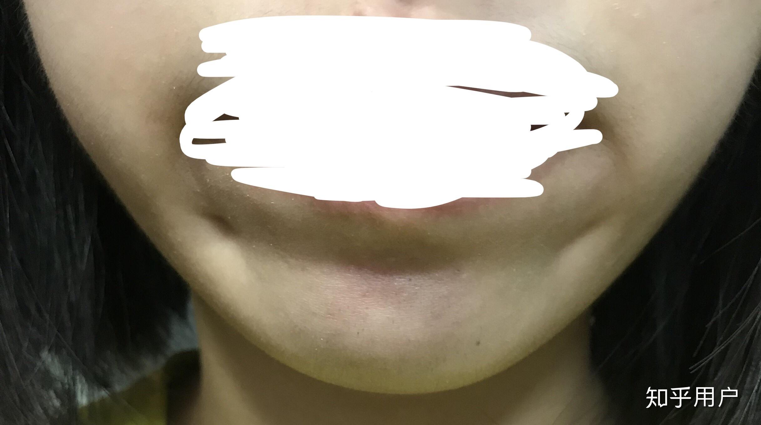 我嘴角下方凹进去是酒窝还是梨窝～还是别的什么～? - 知乎