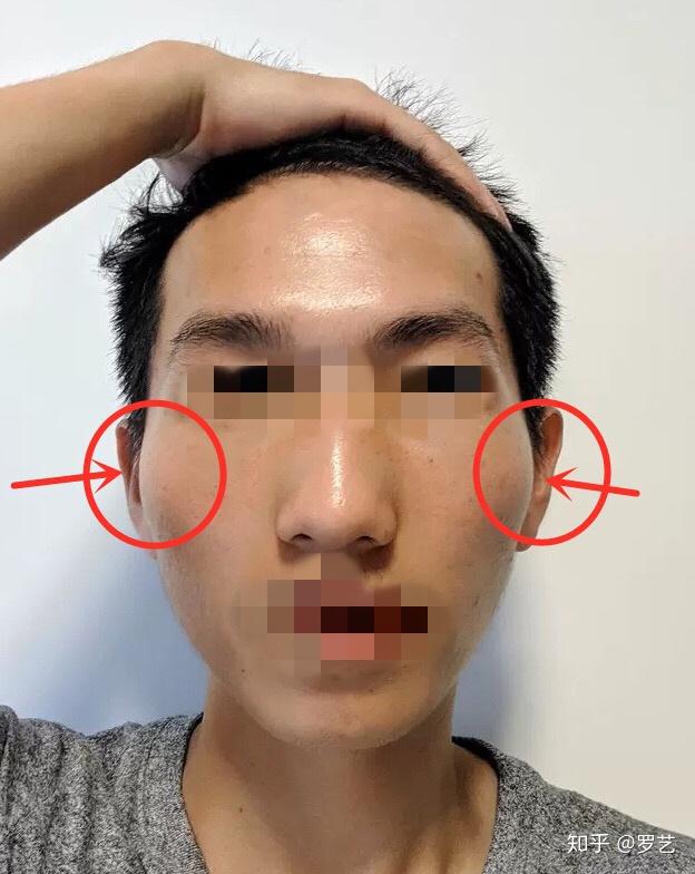 男生颧骨高有什么合适的短发发型推荐? - 知乎