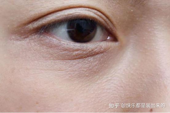 28岁了感觉眼周皱纹在慢慢变深什么方法淡化细纹比较有效呢