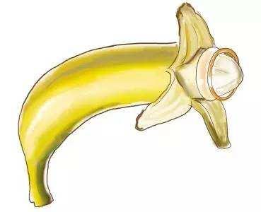 包皮红肿影响夫妻生活吗