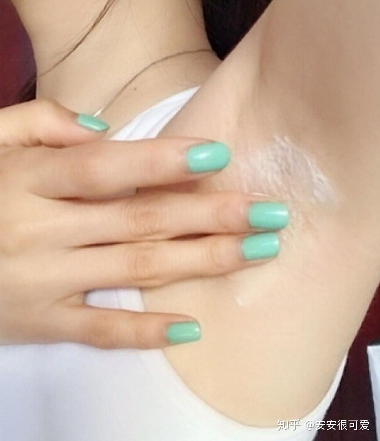 激光脱毛疼不疼