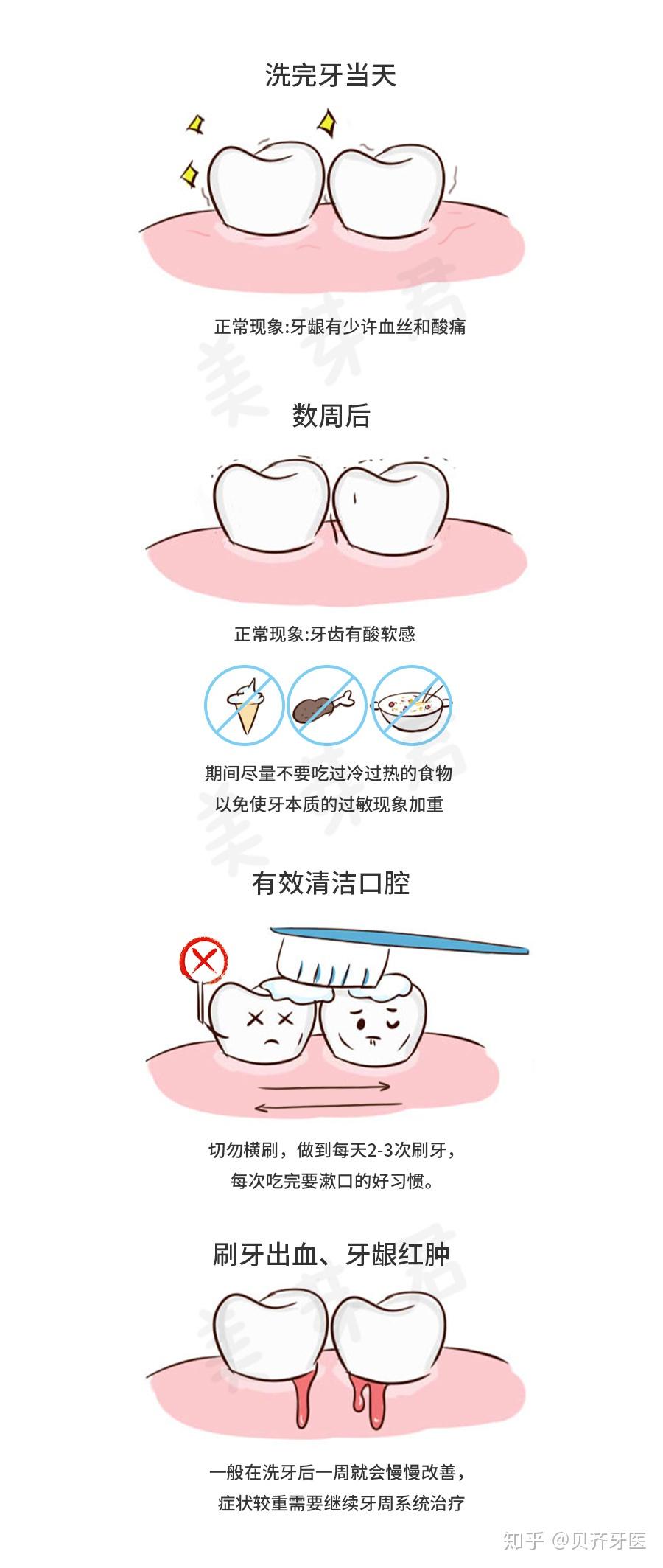 洗牙要注意什么?