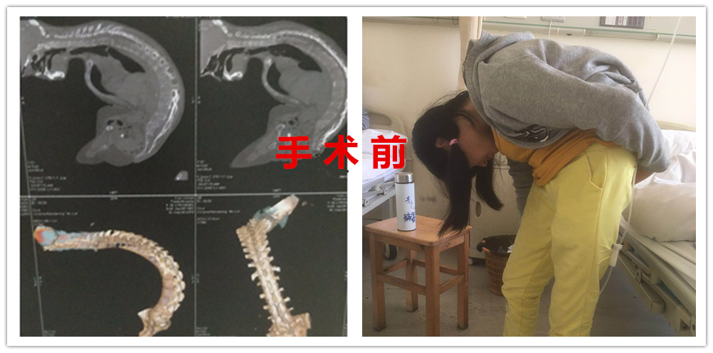 v2-de5d229f19dc11d35a12ad54b6349a92_1440w.jpg?source=172ae18b